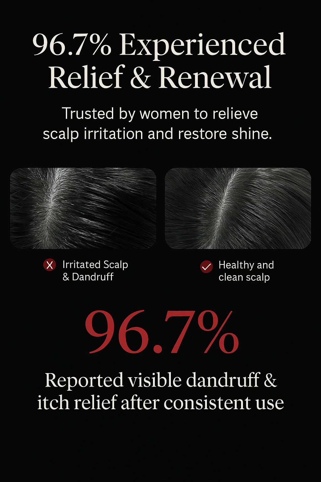 Flat lay of natural oils, a scalp massage comb, herbal tea, and fresh greens representing natural scalp health remedies.